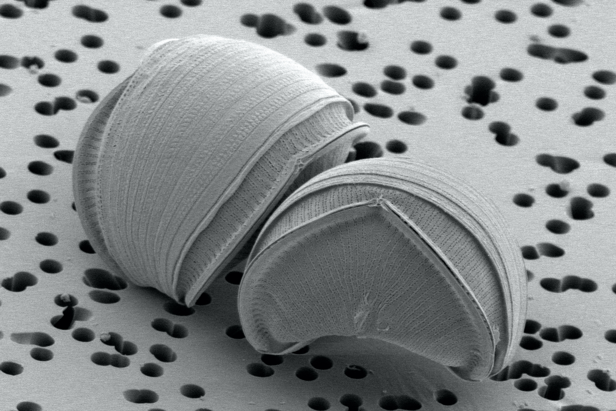 One of the new diatom species, Epithemia pelagica, as seen under a scanning electron microscope.