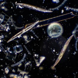 Microscopy image of diatoms, photosynthesizing algae.
