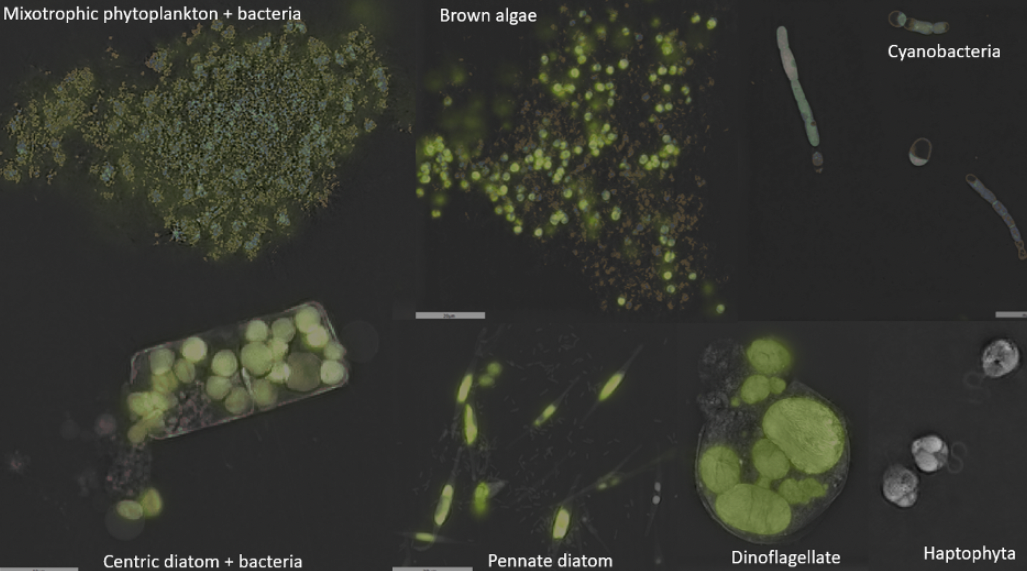 Microscopy image: black background with green colored microbes of various shapes and sizes.